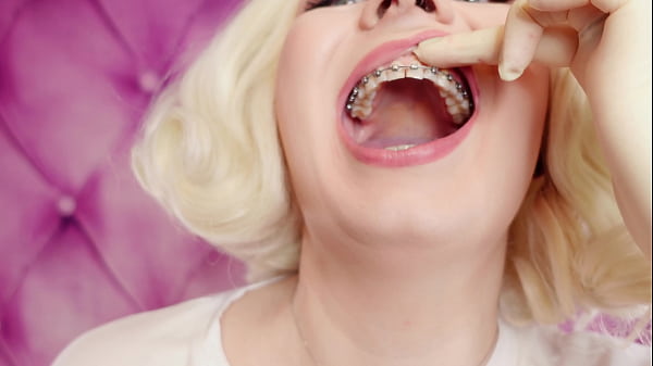Latex Medical Gloves and Eating Ice Cream (Food Fetish) with Braces